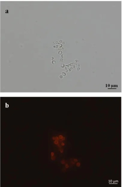 Figure 3.26: Bright field (a) and fluorescence microscopy (b) images of EBY100 cells transformed  with pETcon plasmid expressing Htt-103Q upon galactose induction