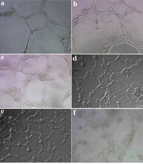 Figure  2.16.  In  vitro  angiogenesis  assay  -  Matrigel,  HM-PA  and  D-PA.  HUVECs  were  cultured  on  Matrigel  (a,  b),  HM-PA  nanofiber  matrix  (c,  d  and  e)  and  D-PA  nanofiber  matrix  (f);  then  followed  for  48  h  to  evaluate  migrati