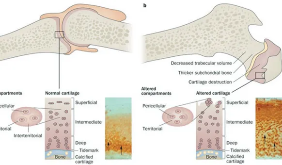 Fig. 7.1 (a) Representation of healthy joint of articular  cartilage. Pericellular, territorial and interterritorial  matri-ces form articular cartilage and each of them place at  par-ticular distance from the chondrocytes