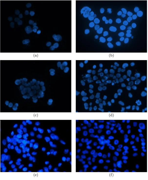 Figure 2.1: Several example fluorescence microscope image segments: (a), (c), (e) are taken from the HepG2 dataset; (b), (d), (f) are taken from the Huh7 dataset.