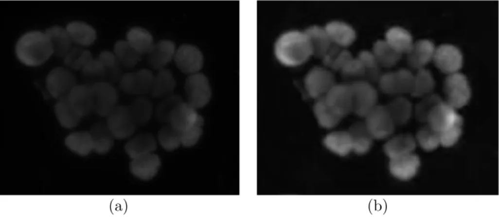 Figure 2.3: Results of applying preprocessing methods to the image: (a) an example fluorescence image with high intensity variations and nonuniform shades due to uneven illumination, (b) the resulting image after preprocessing.