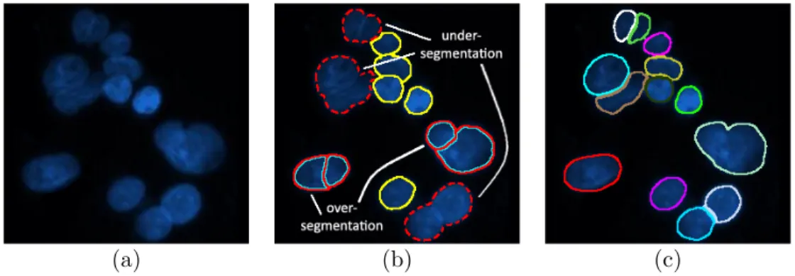 Figure 2.4: Illustrations of true, oversegmented, and undersegmented cells: (a) a sample fluorescence microscopy image, (b) segmentation results, where  overseg-mented cells are annotated with red-cyan lines, undersegoverseg-mented cells are  anno-tated wi