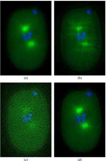 Fig. 12. The deconvolution results for FL image downloaded from [http://bigwww.epﬂ.ch/algorithms/mltldeconvolution/] (a) blurred image, (b) deblurred by the blind deconvolution using phase information (the images and the codes are provided in  http://signa