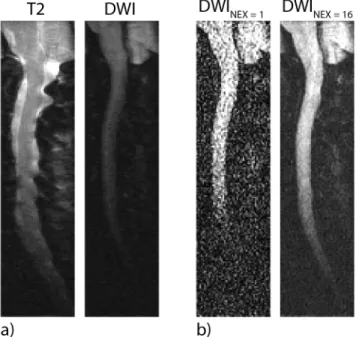 Figure 2.3: Comparison of signal levels. For each subgure, the images are dis- dis-played with identical gray-scale windowing