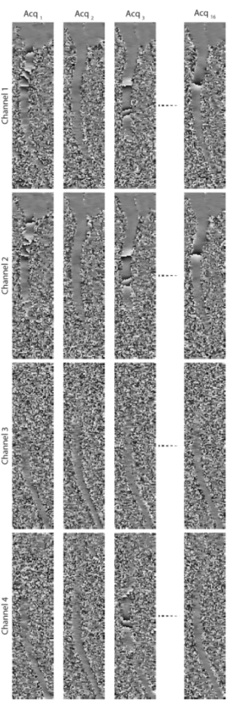 Figure 2.6: Phase images from each acquisition for the case when diusion-encoding is along the A/P direction.