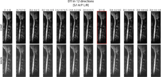 Figure 2.8: Diusion-weighted images from DTI of the spinal cord in 12 dierent directions