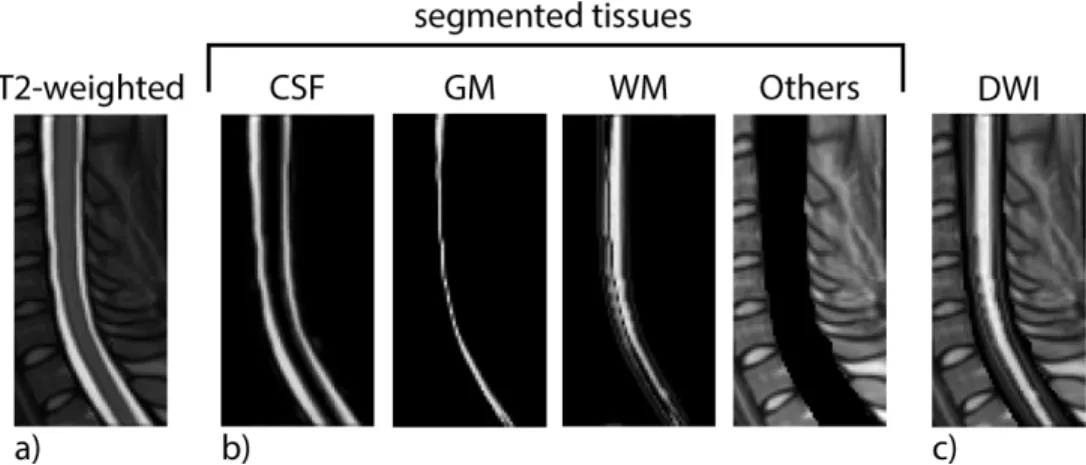 Figure 3.2: Process for simulating a diusion-weighted image based on a T2- T2-weighted input image
