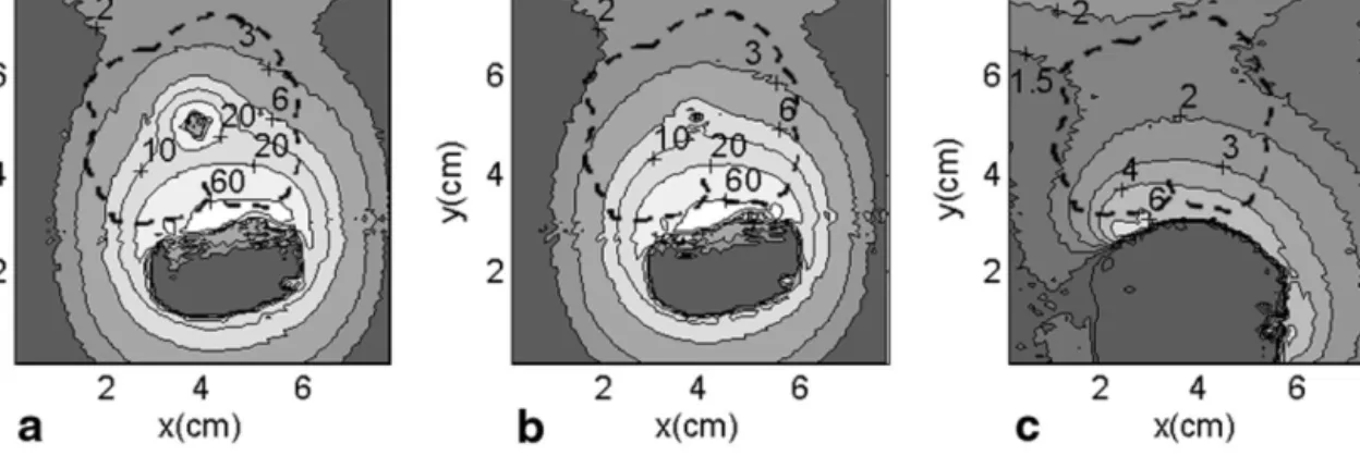 Figure 3 shows phantom SNR measurements for our proposed phased-array system (with the loopless antenna replacing the endourethral loop coil in Fig