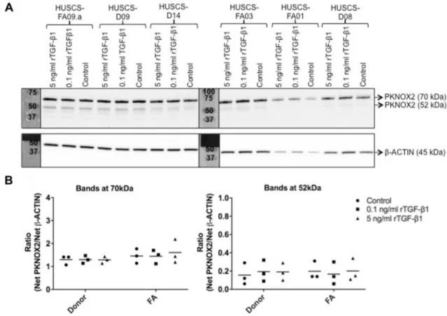 Fig. 5    rTGF-β1 protein induction had no effect on PKNOX2 protein  level of FA (n = 3) and donor (n = 3) BM-MSCs