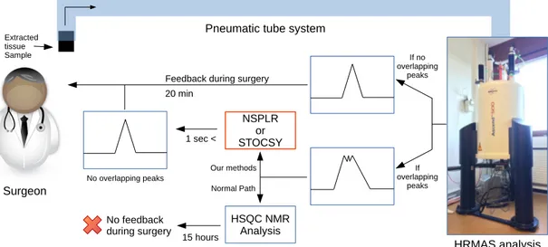 Figure 3.1: This figure shows the workflow of the feedback mechanism that we suggest. Surgeon extracts a sample from excision cavity and sends it to the  spec-troscopy room where HRMAS NMR analysis is conducted