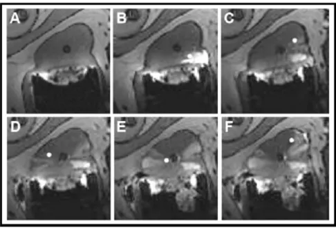 Fig. 6. CanineMultiple-InjectionTrials: Completetissueenhance- Completetissueenhance-ment