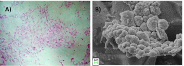 Figure 5. (A) Representative CFU-activity of mesenchymal stem cells on p(HEMA-PEG-MA-2; (B) Exemplified SEM image of mesenchymal stem cells grown on the p(HEMA-PEG-MA)-2 hydrogel films.