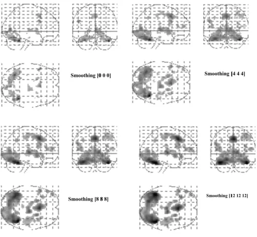 FIGURE 7. MIP results of Several values (0,4, 8, and 12 mm FWHM) of the smoothing of variance.