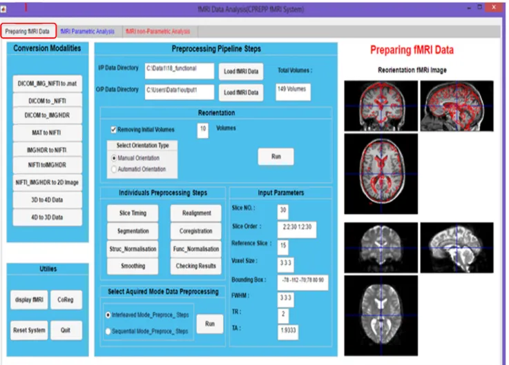 FIGURE 2. Main window of preparing fMRI data analysis.