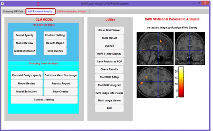 FIGURE 3. Main window of fMRI statistical parametric analysis.