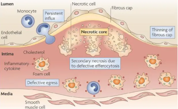 Figure 1.3 The Molecular Mechanism of Atherosclerosis 