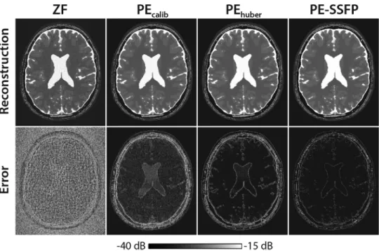 FIG. 4. Representative bSSFP images of the numerical phantom for N¼ 4 were reconstructed using ZF and PE-SSFP