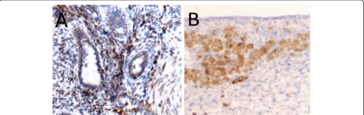 Fig. 1 Different expression of Oct-4 in endometrial tissues by immunohistochemistry (× 200)