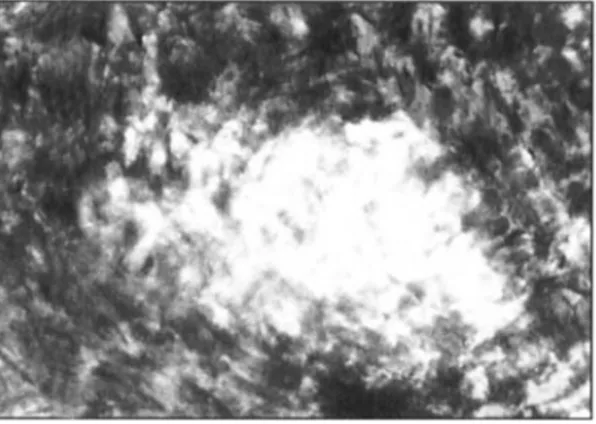 Figure  8  Cross-section of  BTG  modified cotton dyed  with APAN  weight  gain  percentage needs to be  a a 