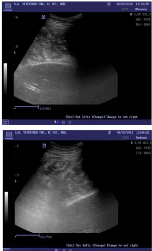 Fig. 3: Sonogram view of right fossa paralumbal area in the present case. 