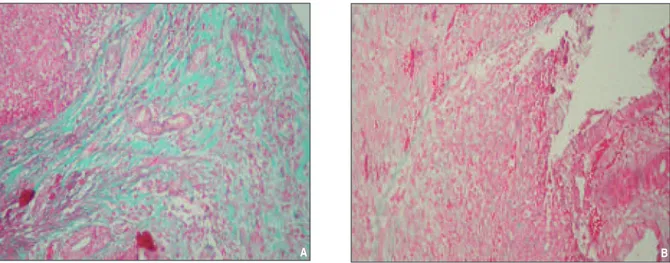 TABLE 2:  Comparison of acute inflammation, chronic inflammation, the amounts of granulation tissue,  fibroblast maturation, collagen deposition, reepithelization, neovascularization scores between two groups.