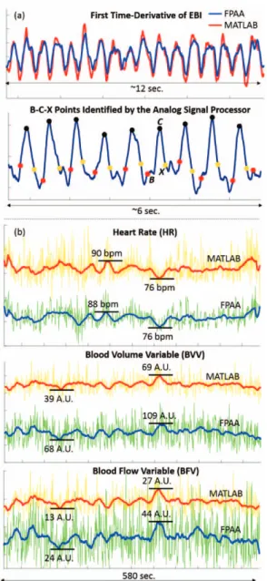 Fig. 6. (a) Comparison of the time-derivative IPG signals obtained from  the ASP implemented on the FPAA and digital implementation on  MATLAB