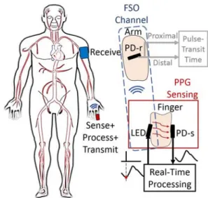 Fig. 1. A sense, process, and transceiver system measures  photoplethysmography (PPG) signal, detects PPG foot-points in near  real-time, and transmits the temporal information of foot-points to a receiver  located at a distance; for pulse transit time mea