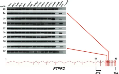 FIG. 3. Q-RT-PCR analysis of PTPRD in HCC cell lines. GAPDH was used as an internal control