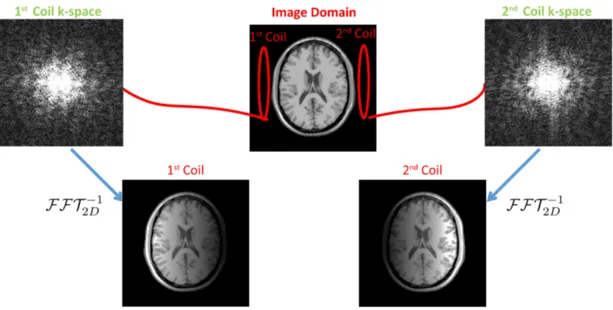 Figure 2.2: Multi-coil image acquisition. The image from each coil corresponds to the full MRI image multiplied by the sensitivity map of that coil.
