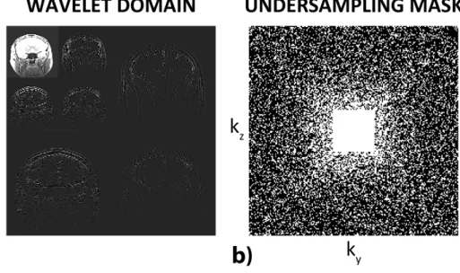 Figure 2.4: a) Wavelet domain representation of an MRI image. This repre- repre-sentation is sparse, as most of the pixels in Wavelet domain are zero or have values very close to zero