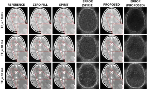 Figure 3.3: Representative results from the numerical brain phantom, showing the reconstructed T 2 -weighted images with different echo times (TE = 10, 30, and 50 ms)