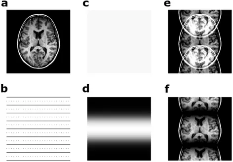 Figure 2.2: The effect of localized coil sensitivities on images received by coils with scanned acceleration: (a) original image, (b) acceleration pattern, with every other line in k y skipped compared to a full Nyquist acquisition, (c,d) two different coi