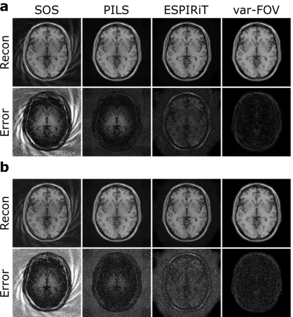Figure 3.4: SOS, PILS, ESPIRiT and var-FOV reconstructions of brain data at R=3.7 for (a) SNR=20, (b) SNR=10