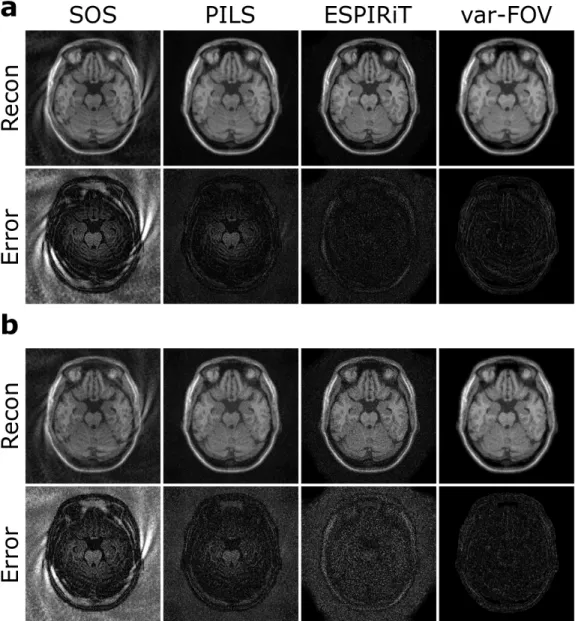 Figure 3.5: SOS, PILS, ESPIRiT and var-FOV reconstructions of brain data at R=4.2 for (a) SNR=20, (b) SNR=10