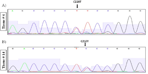 Figure 3.4 Representative sequence chromatograms of HCC tumor samples carrying  TERT promoter mutations C228T and C250T 
