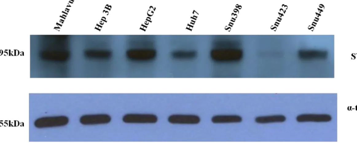 Figure 3.8 STAT1 protein is differentially expressed in HCC cell lines. 