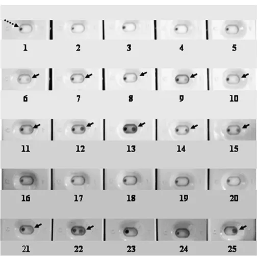 Fig. 5. Specificity of the rPvpA336-based ERIFA test by using M. gallisepticum (MG) and M