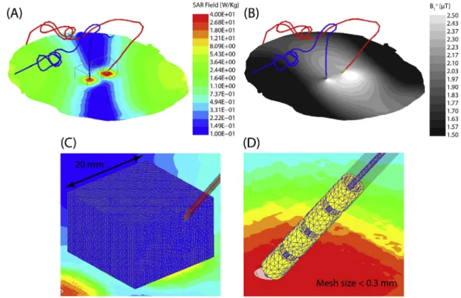 Fig. 5 (solid lines) gives the maximum of 1g-averaged SAR (Max1g- (Max1g-SAR) around tips of right and left DBS electrodes for a full range of coil rotation angles