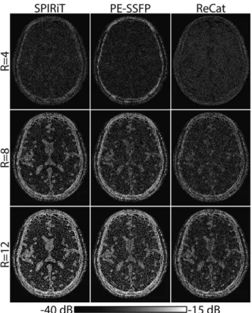 FIG. 4. SPIRiT, PE-SSFP, and ReCat reconstructions of the simu- simu-lated brain phantom were performed at N ¼ 4 and D ¼ 8
