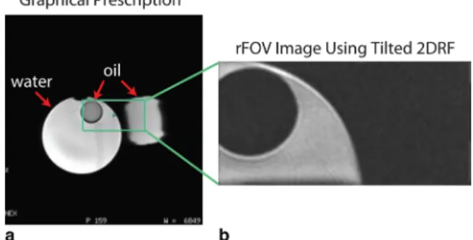 Figure 4 shows simulation results for the effects of the number of prescribed slices on signal level