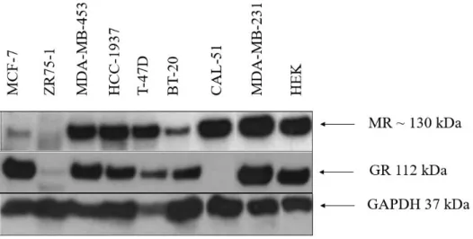 Figure 3.1: Expression patterns of MR and GR in breast cancer cell line protein panel