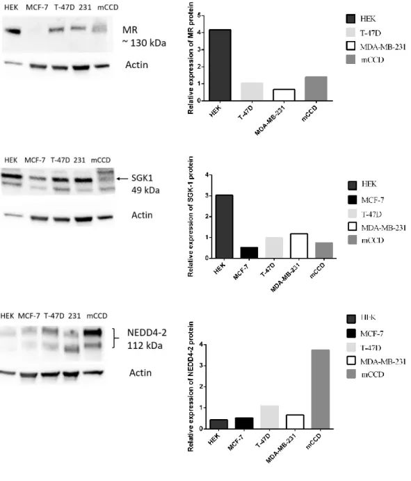Figure 3.3: MR, SGK1 and NEDD4-2 expressions across ER (+) and ER (-) breast cancer  cell lines