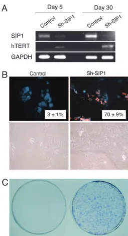 Fig. 4. ShRNA-mediated down-regulation of endogeneous SIP1 transcripts releases hTERT repression and rescues C3 cells from senescence arrest