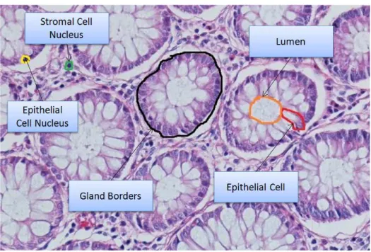 Figure 2.1: An example of a colon tissue stained with hematoxylin-and-eosin.