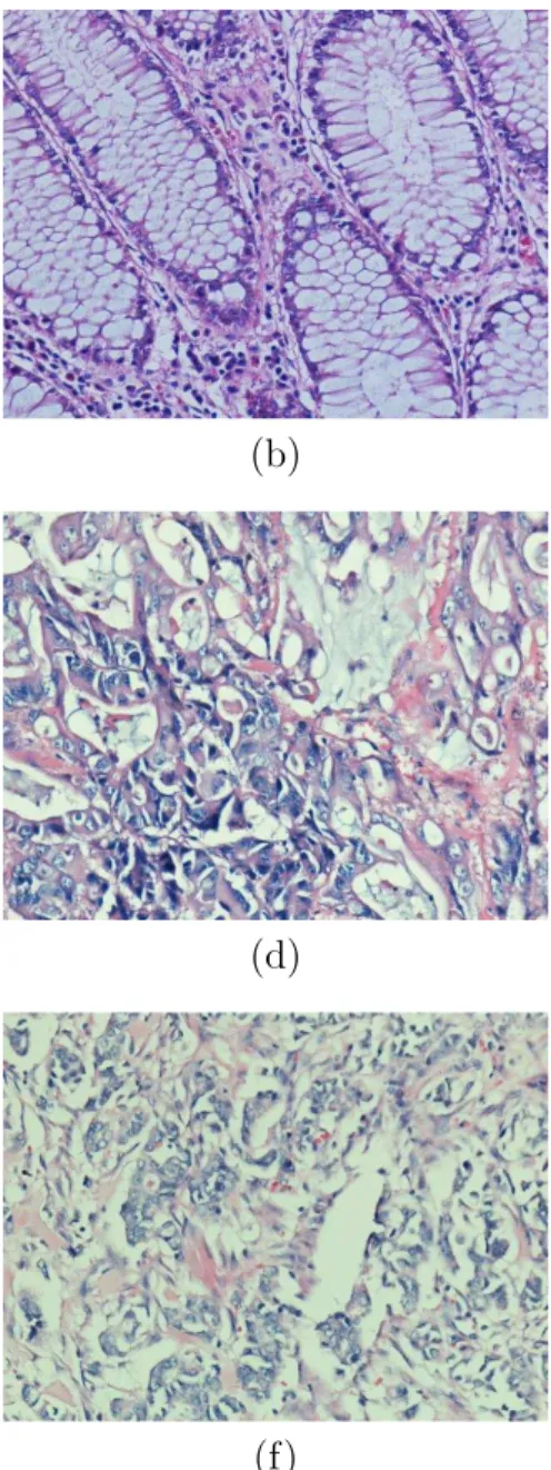 Figure 2.2: An illustration of example tissue images from different cancer types: