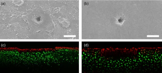 Fig. 1. SEM images of typical damage craters caused by a single burst of pulses incident on (a) superficial-zone cartilage and (b) transition-zone  cartilage, scale bars are 10 µm