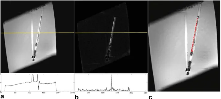 FIG. 5. Sagittal images of the oil phantom, KCl solution filled straw (left), the ICRF coil (right), and the normalized performance plots (yellow line on the image) using the reverse polarization method for transmit array system