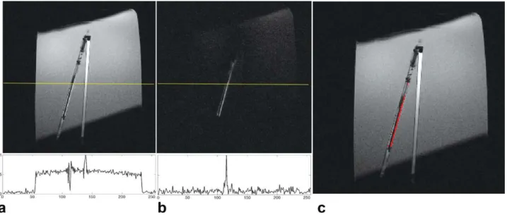 Figure 4 shows the oblique images of an oil phantom with two straws, one filled with KCl solution (left) and the other with the RCRF coil (right) inside