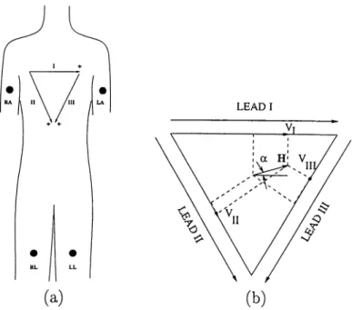 Figure  2.4:  (a)  Placement  of electrodes  for standard  leads,  (b)  The  Einthoven  triangle