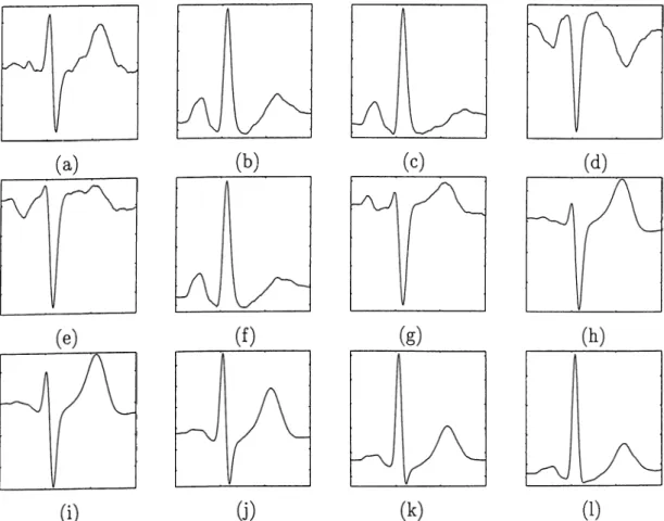 Figure  2.6:  Typical  ECG  waveforms  of (a)  D1  (b)  D2  (c)  D3  (d)  aVR  (e)  aVL  (f)  aVF  (g)  VI  (h)  V2  (i)  V3  (j)  V4  (k)  V5  (1)  V6